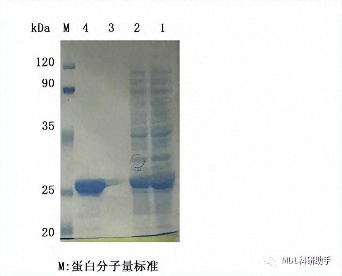 原核蛋白表达的整体实验流程和具体实验结果