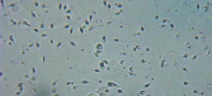 揭秘：精子的钻头式螺旋前进方式