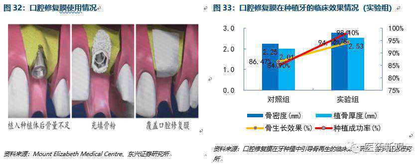 劣质空压机滤芯正在杀死你的螺杆空压机！