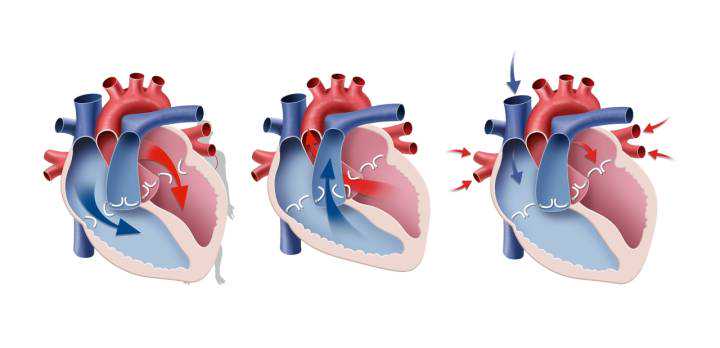 心脏这台泵老了、累了，需要给它“充充电”