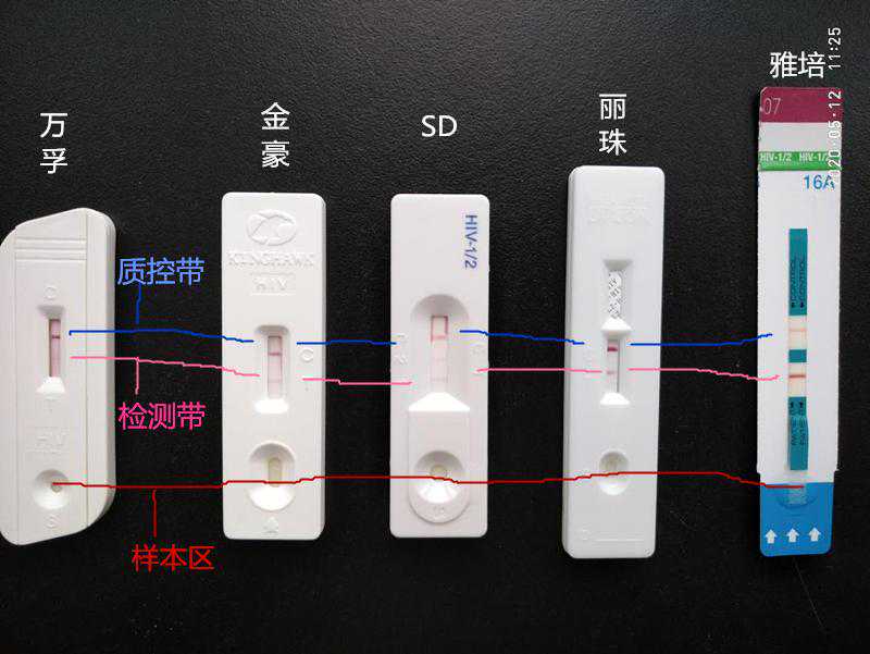 你知道艾滋病确诊结果长什么样吗？